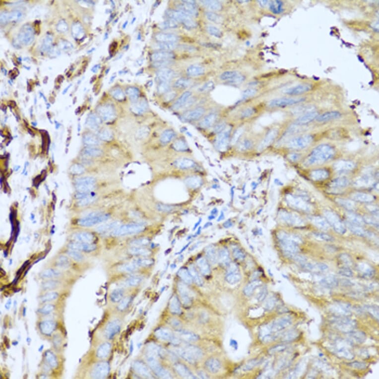 Immunohistochemistry - Anti-CSH1 Antibody (A8985) - Antibodies.com