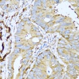 Immunohistochemistry - Anti-CSH1 Antibody (A8985) - Antibodies.com