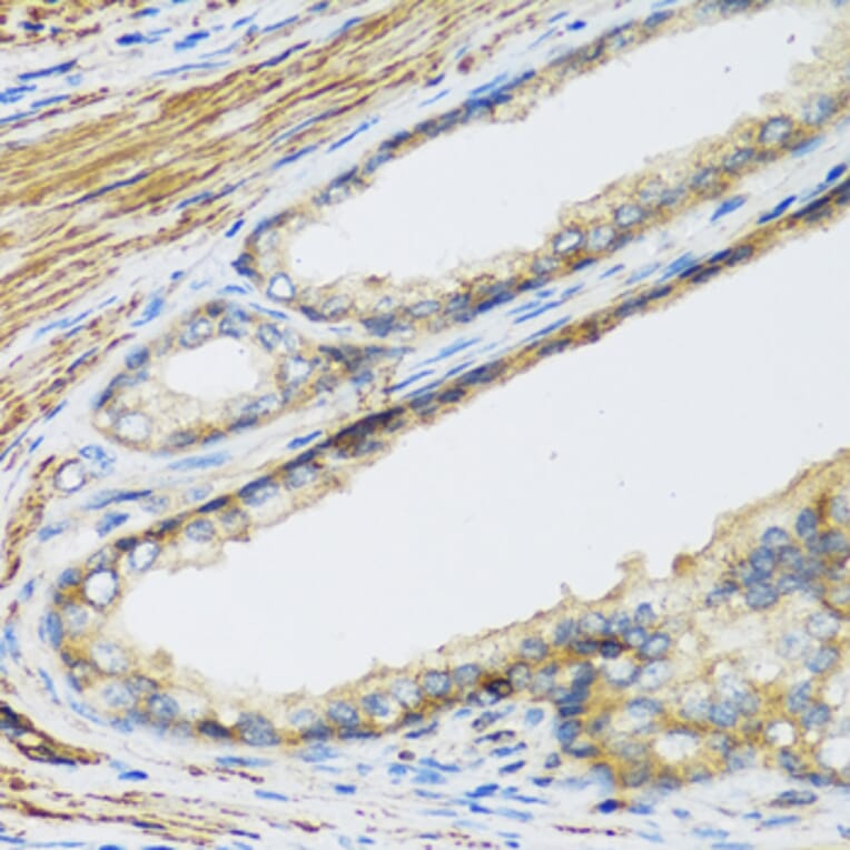 Immunohistochemistry - Anti-CSH1 Antibody (A8985) - Antibodies.com