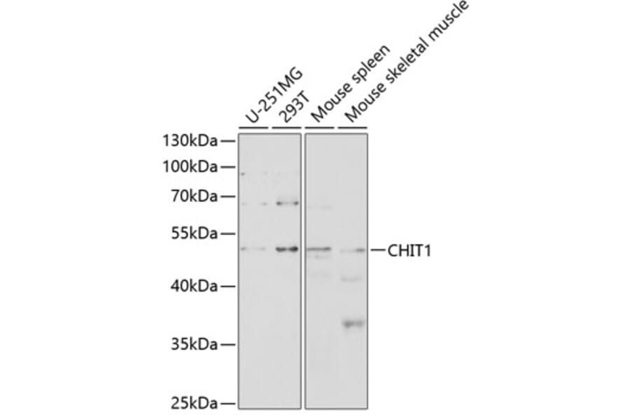 Western Blot - Anti-CHIT1 Antibody (A8987) - Antibodies.com