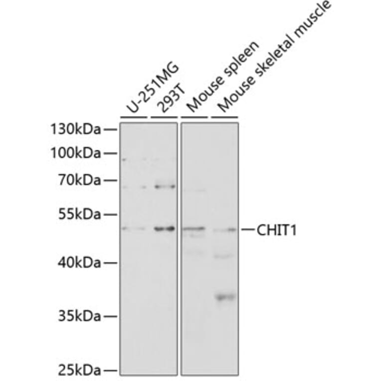 Western Blot - Anti-CHIT1 Antibody (A8987) - Antibodies.com