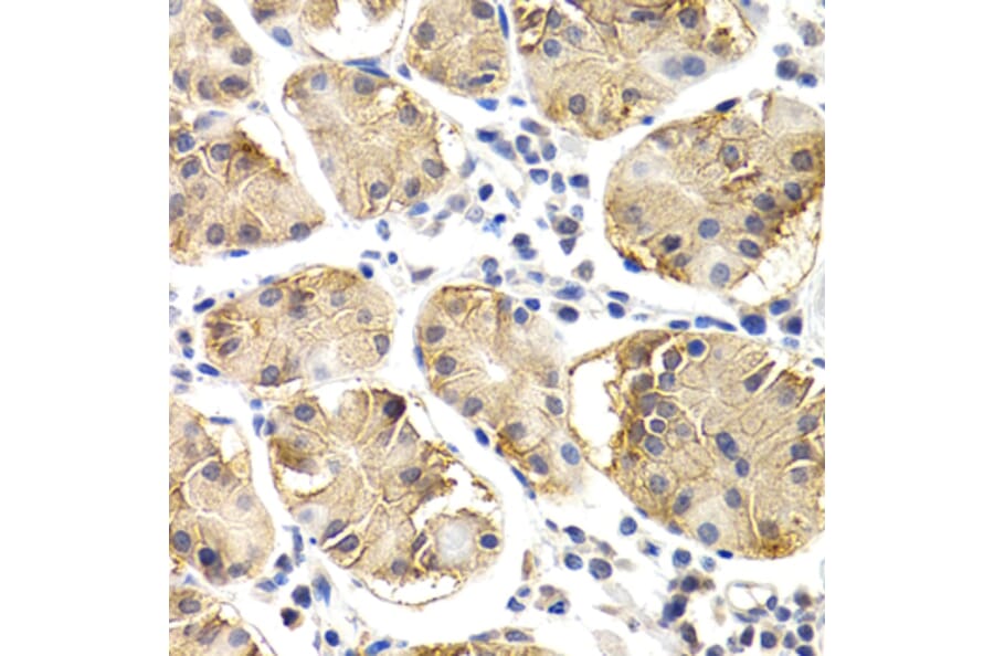 Immunohistochemistry - Anti-CHIT1 Antibody (A8987) - Antibodies.com