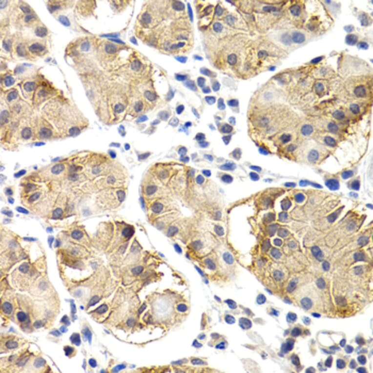Immunohistochemistry - Anti-CHIT1 Antibody (A8987) - Antibodies.com