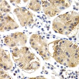Immunohistochemistry - Anti-CHIT1 Antibody (A8987) - Antibodies.com