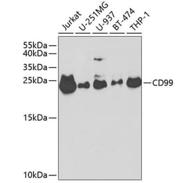 Western Blot - Anti-CD99 Antibody (A8988) - Antibodies.com