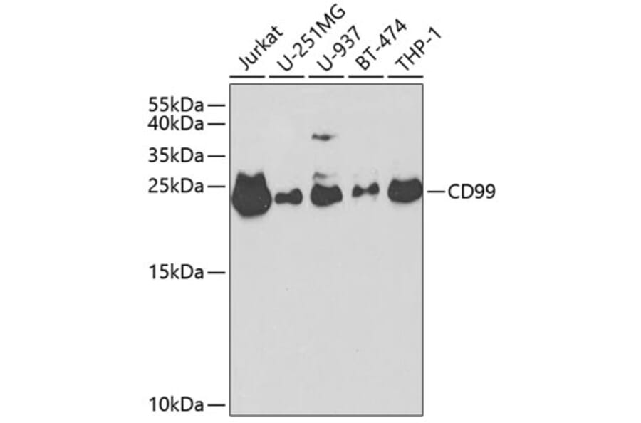 Western Blot - Anti-CD99 Antibody (A8988) - Antibodies.com