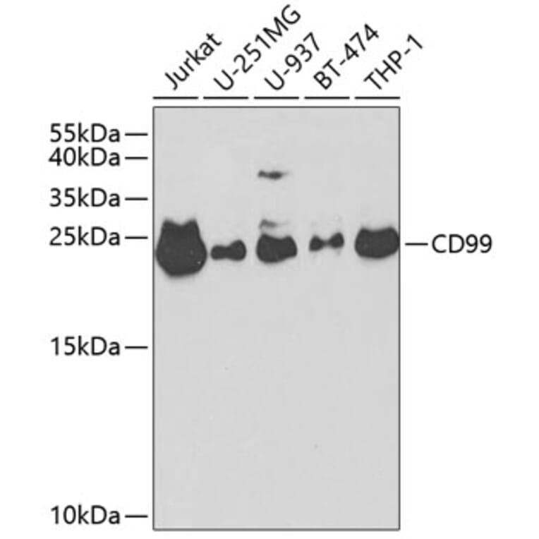 Western Blot - Anti-CD99 Antibody (A8988) - Antibodies.com