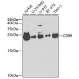 Western Blot - Anti-CD99 Antibody (A8988) - Antibodies.com