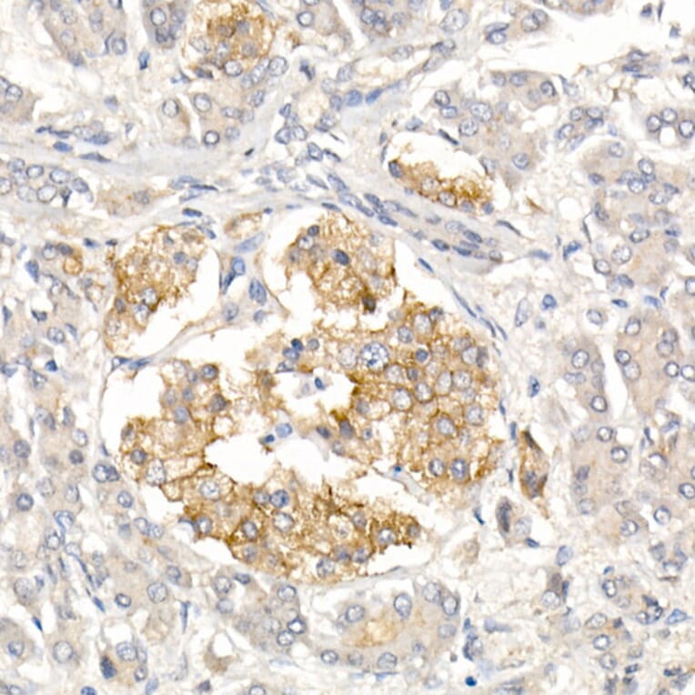 Immunohistochemistry - Anti-CD99 Antibody (A8988) - Antibodies.com