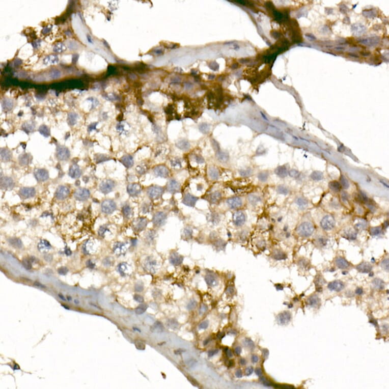 Immunohistochemistry - Anti-CD99 Antibody (A8988) - Antibodies.com
