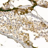 Immunohistochemistry - Anti-CD99 Antibody (A8988) - Antibodies.com