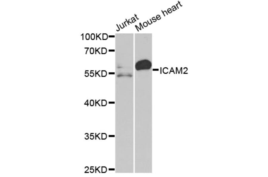Western Blot - Anti-ICAM2 Antibody (A2038) - Antibodies.com