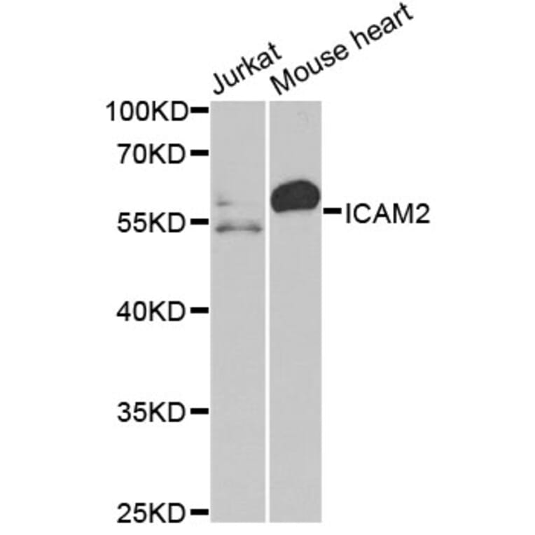 Western Blot - Anti-ICAM2 Antibody (A2038) - Antibodies.com