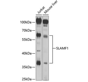 Western Blot - Anti-SLAM / CD150 Antibody (A8990) - Antibodies.com