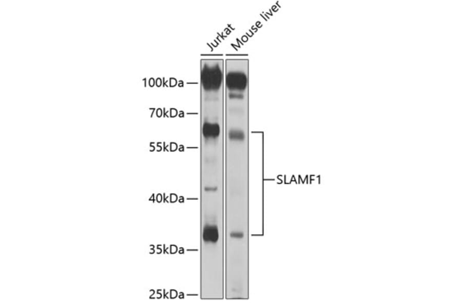 Western Blot - Anti-SLAM/CD150 Antibody (A8990) - Antibodies.com