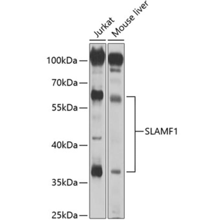 Western Blot - Anti-SLAM / CD150 Antibody (A8990) - Antibodies.com