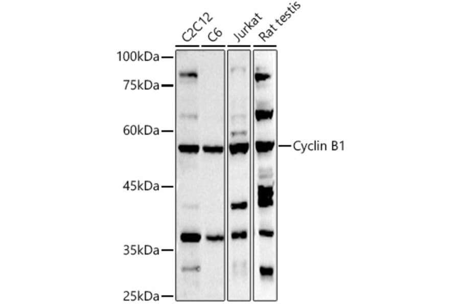 Western Blot - Anti-Cyclin B1 Antibody (A8991) - Antibodies.com