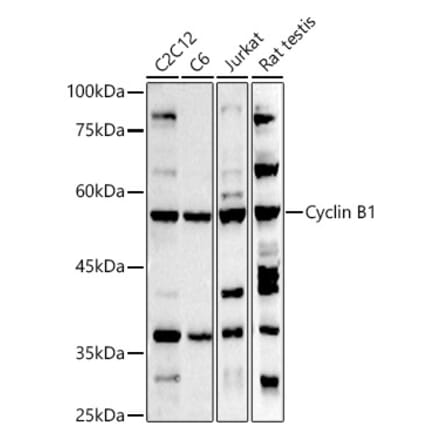 Western Blot - Anti-Cyclin B1 Antibody (A8991) - Antibodies.com