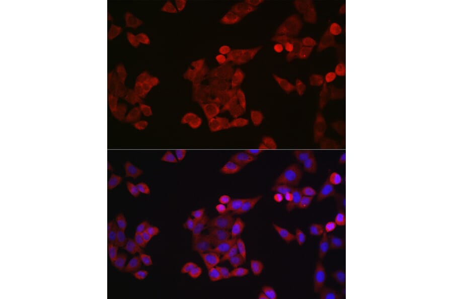 Immunofluorescence - Anti-Cyclin B1 Antibody (A8991) - Antibodies.com