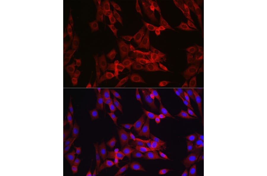 Immunofluorescence - Anti-Cyclin B1 Antibody (A8991) - Antibodies.com