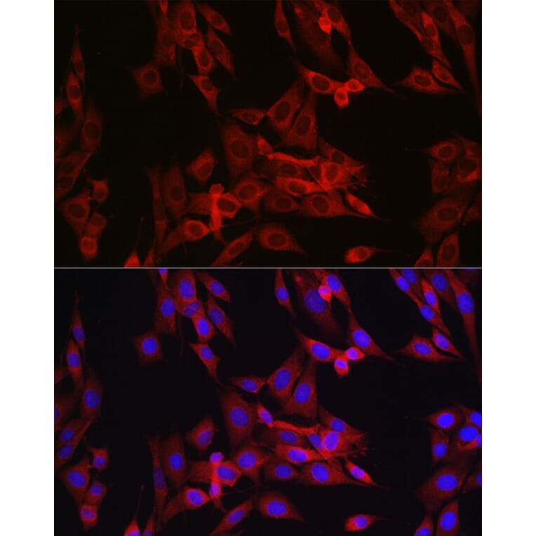 Immunofluorescence - Anti-Cyclin B1 Antibody (A8991) - Antibodies.com