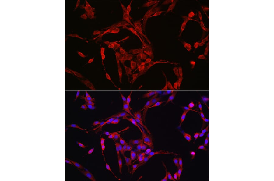 Immunofluorescence - Anti-Cyclin B1 Antibody (A8991) - Antibodies.com