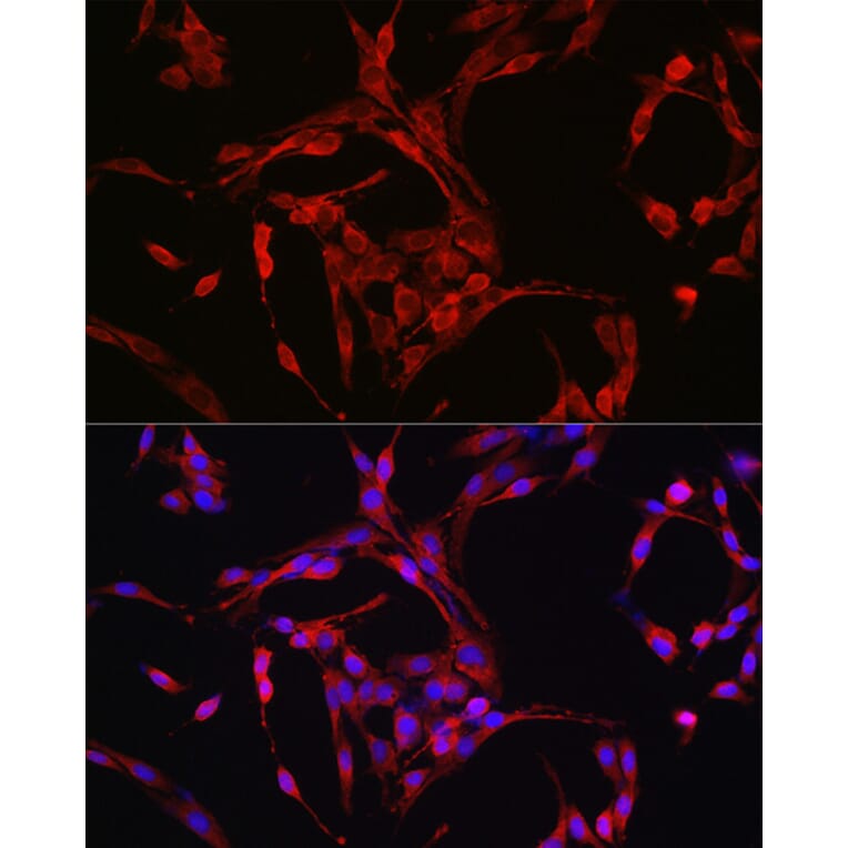 Immunofluorescence - Anti-Cyclin B1 Antibody (A8991) - Antibodies.com