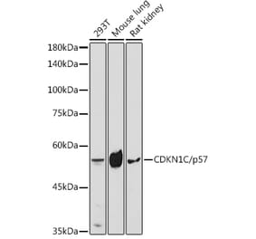 Western Blot - Anti-p57 Kip2 Antibody (A8993) - Antibodies.com