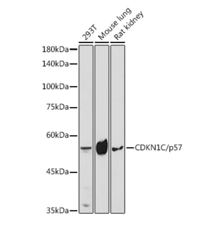 Western Blot - Anti-p57 Kip2 Antibody (A8993) - Antibodies.com