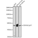 Western Blot - Anti-p57 Kip2 Antibody (A8993) - Antibodies.com