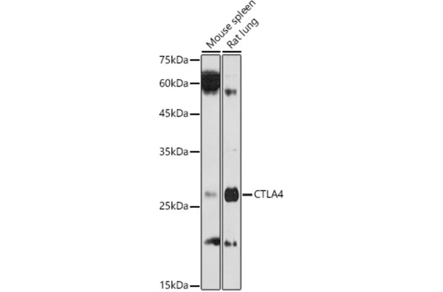 Western Blot - Anti-CTLA4 Antibody (A8994) - Antibodies.com
