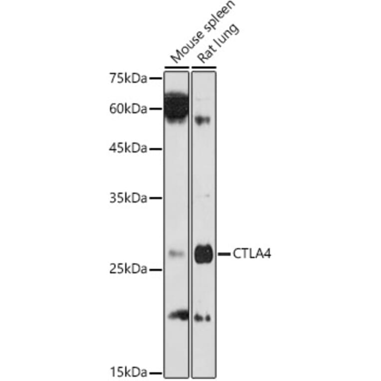 Western Blot - Anti-CTLA4 Antibody (A8994) - Antibodies.com