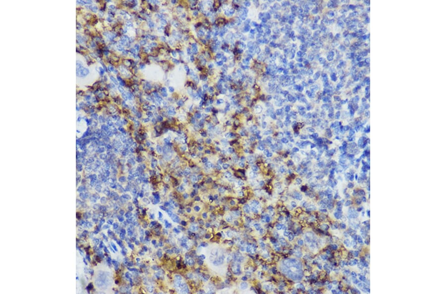 Immunohistochemistry - Anti-CTLA4 Antibody (A8994) - Antibodies.com