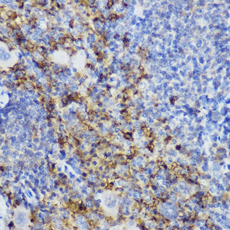 Immunohistochemistry - Anti-CTLA4 Antibody (A8994) - Antibodies.com