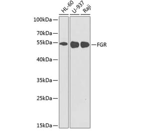 Western Blot - Anti-FGR Antibody (A8995) - Antibodies.com