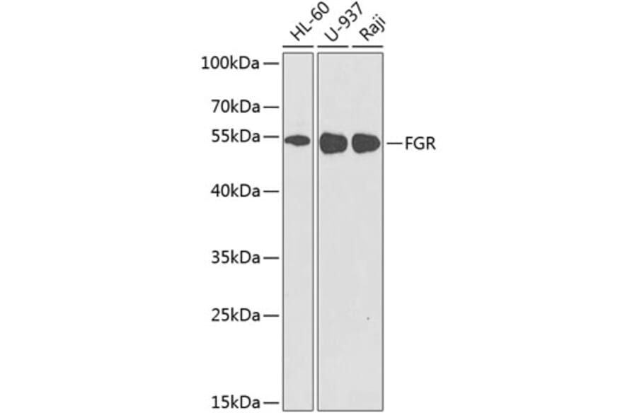 Western Blot - Anti-FGR Antibody (A8995) - Antibodies.com