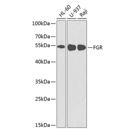 Western Blot - Anti-FGR Antibody (A8995) - Antibodies.com