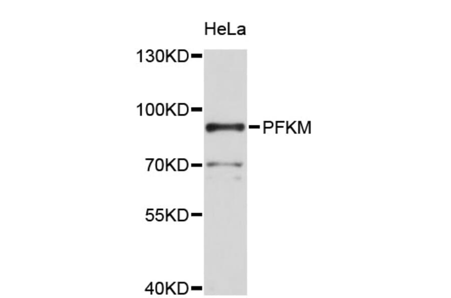 Western Blot - Anti-PFKM Antibody (A2078) - Antibodies.com