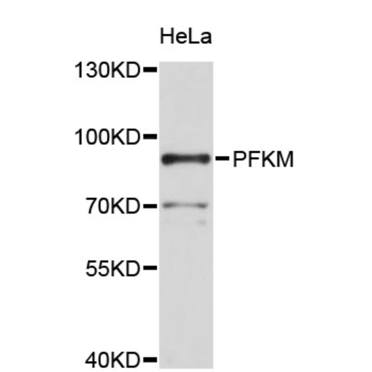 Western Blot - Anti-PFKM Antibody (A2078) - Antibodies.com