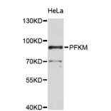 Western Blot - Anti-PFKM Antibody (A2078) - Antibodies.com