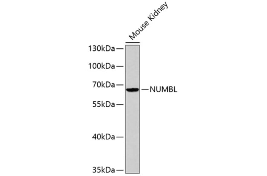 Western Blot - Anti-NUMBL Antibody (A2140) - Antibodies.com