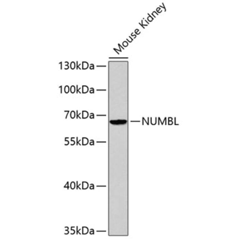 Western Blot - Anti-NUMBL Antibody (A2140) - Antibodies.com