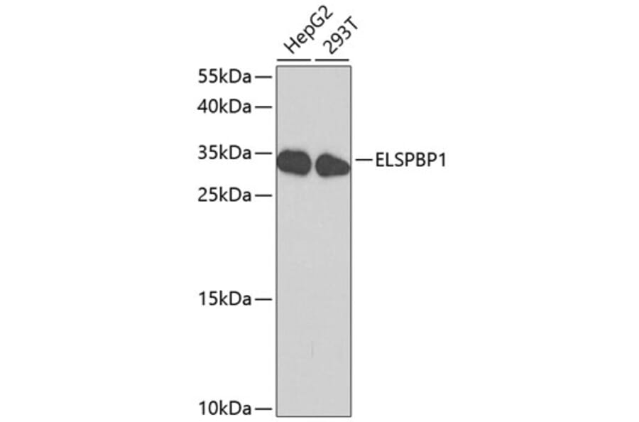 Western Blot - Anti-ELSPBP1 Antibody (A8999) - Antibodies.com