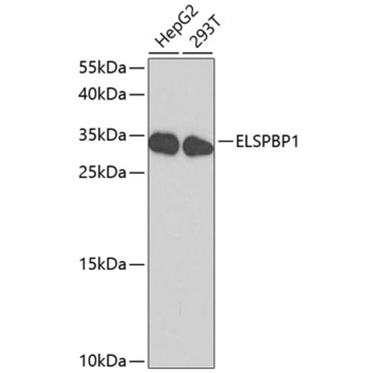 Western Blot - Anti-ELSPBP1 Antibody (A8999) - Antibodies.com
