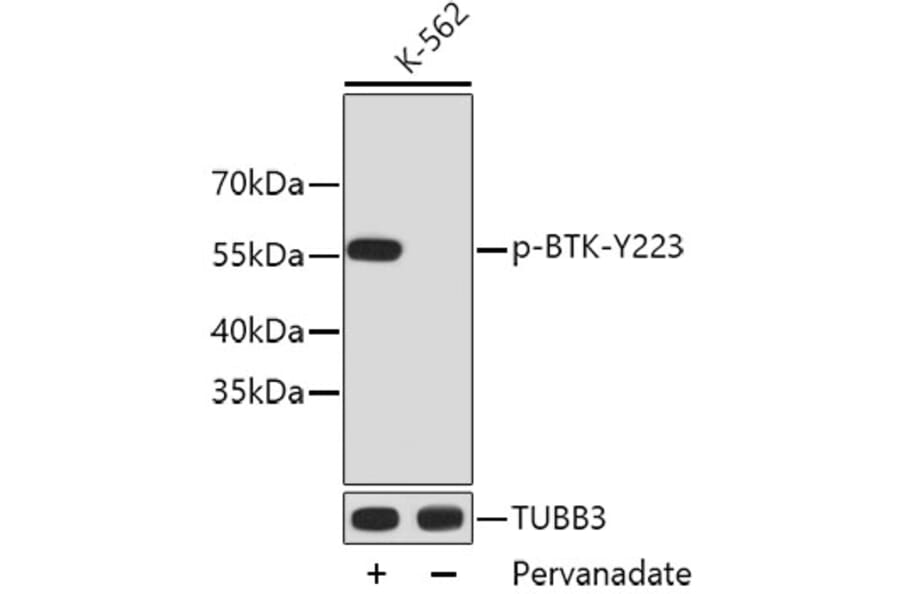 Western Blot - Anti-BTK (phospho Y223) Antibody (AP0645) - Antibodies.com