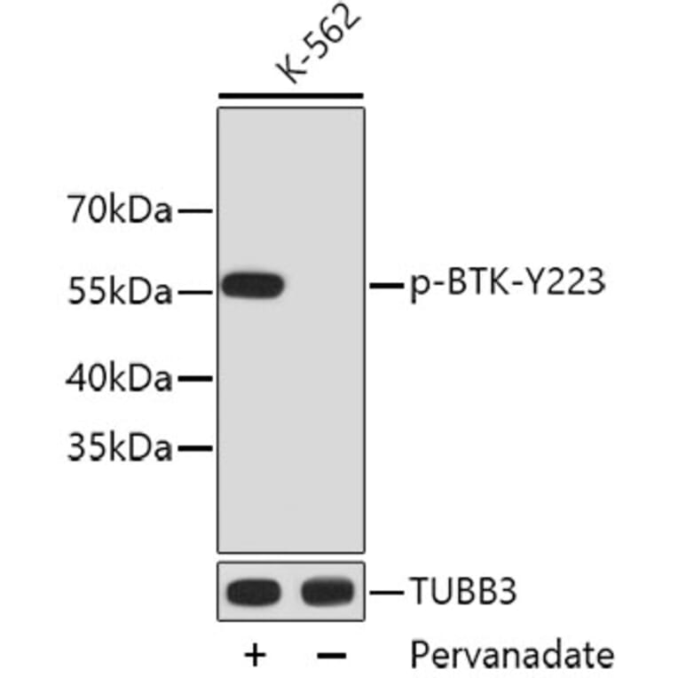Western Blot - Anti-BTK (phospho Y223) Antibody (AP0645) - Antibodies.com