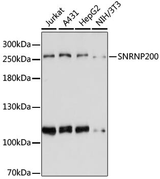 Western blot analysis of extracts of various cell lines, using Anti-SNRNP200 Antibody (A6063) at 1:3000 dilution.
Secondary antibody: Goat Anti-Rabbit IgG (H+L) (HRP) (AS014) at 1:10,000 dilution.
Lysates / proteins: 25µg per lane.
Blocking buffer: 3% non-fat dry milk in TBST.
Detection: ECL Basic Kit (RM00020).
Exposure time: 90s.