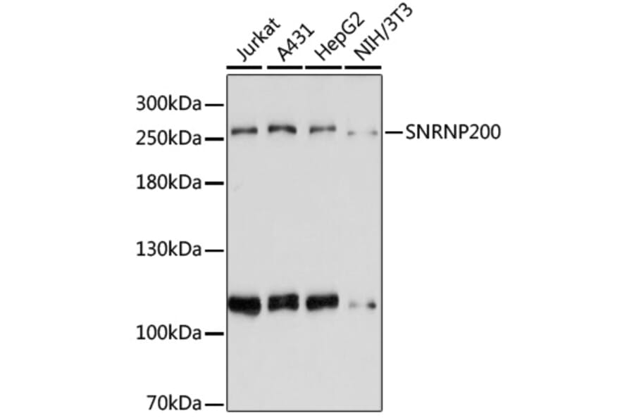 Western Blot - Anti-SNRNP200 Antibody (A80383) - Antibodies.com