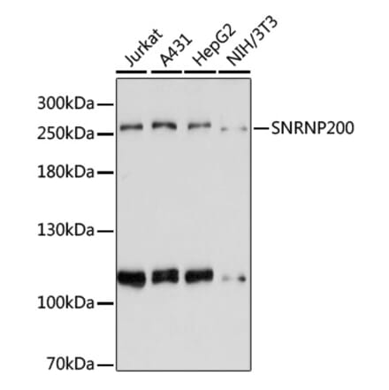 Western Blot - Anti-SNRNP200 Antibody (A80383) - Antibodies.com