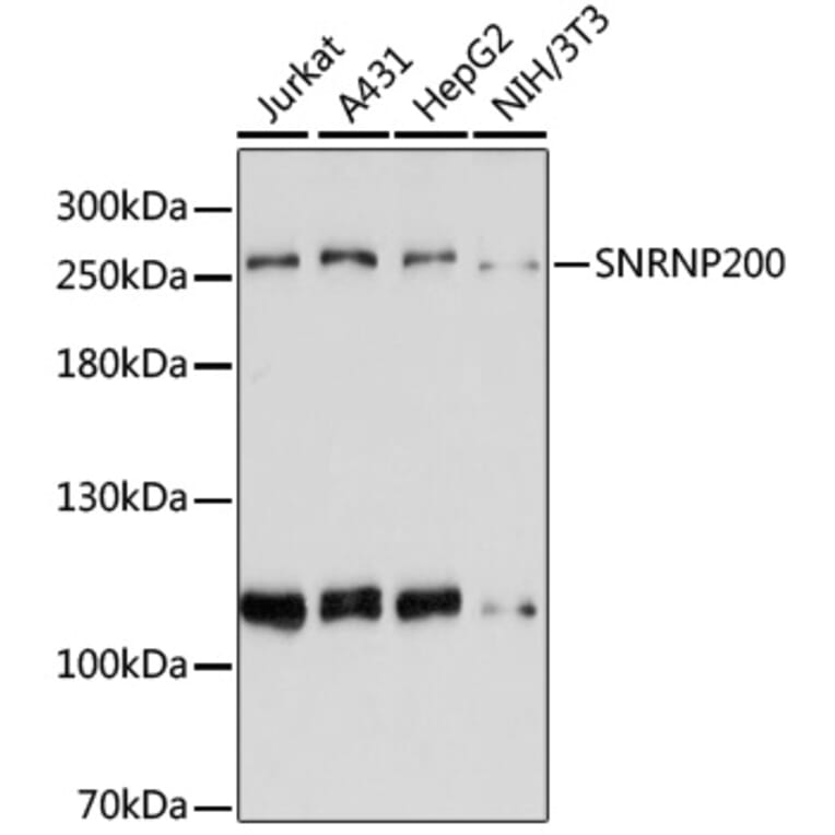 Western Blot - Anti-SNRNP200 Antibody (A80383) - Antibodies.com